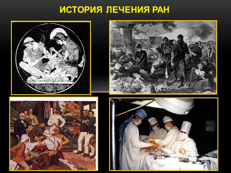 ИСТОРИЯ ЛЕЧЕНИЯ РАН